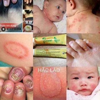 Kem bôi da Thuần Mộc Thanh Mộc Hương mẫu mới dạng tuýp
