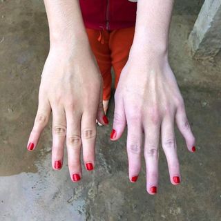 Ủ TRẮNG LÚA MẠCH