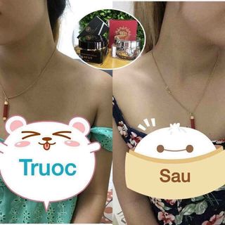 Kem Dưỡng Trắng Body Ngày Đêm