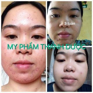 Mỹ Phẩm Thanh Dược Review
