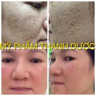 Mỹ Phẩm Thanh Dược giá bao nhiêu