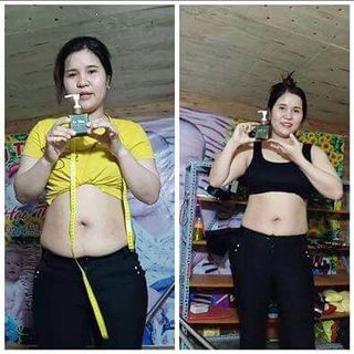 KEM TAN MỠ GOSLIM giá sỉ