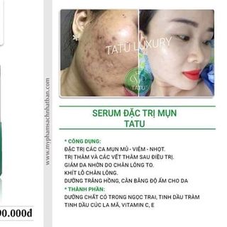 SERUM ĐẶC TRỊ NÁM TATU LUXURY