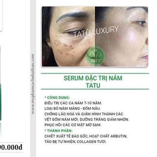 SERUM ĐẶC TRỊ NÁM TATU LUXURY