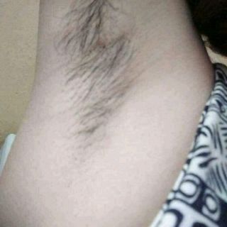 wax weo tẩy lông CTy Ngân Bình