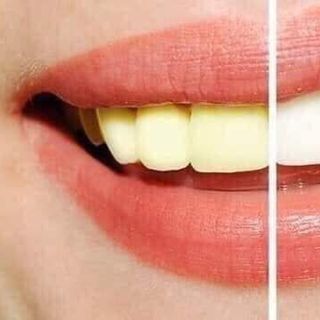 BỘT TRẮNG RĂNG