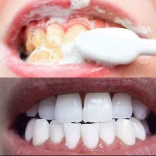 BỘT TRẮNG RĂNG