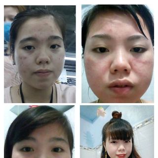 thuốc bắc đẹp da