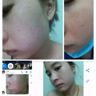 thuốc bắc đẹp da