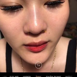 serum tế bào gốc