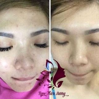 Trị Thâm Ngọc Thiên Hương