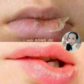 ủ môi hồng gong ju