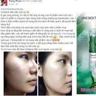 bộ trị mụn trà xanh