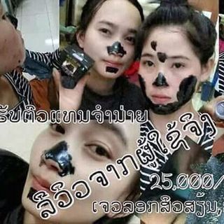 kem lột mụn