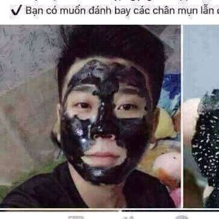 gel lột mụn