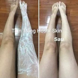Tắm trắng tế bào gốc công nghệ Nhật Bản