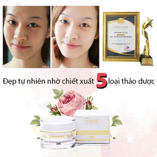 Kem Face dưỡng trắng da