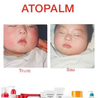 Kem dưỡng ẩm ATOPALM 30ml