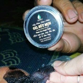 Gel hút mụn Ngân Bình