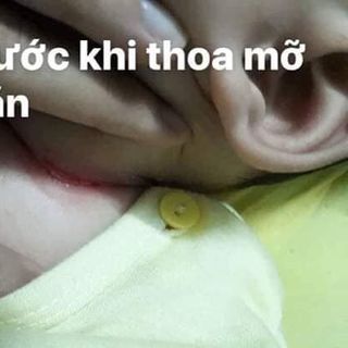 Mỡ trăn Nstore Nguyên chất dùng Kết hợp với Wax shiny và Tinh bột cám gạo cà phê