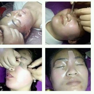 Mặt nạ màng tế bào gốc
