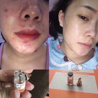 Serum cá hồi