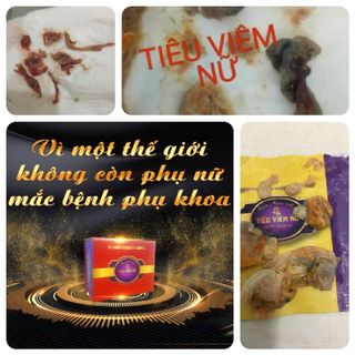 TIÊU VIÊM NỮ