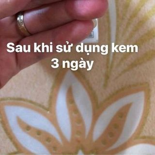 KEM TRỊ Á SỪNG