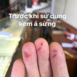 KEM TRỊ Á SỪNG
