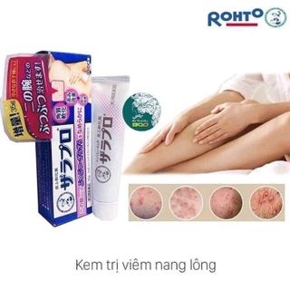 kem trị viêmnang lông