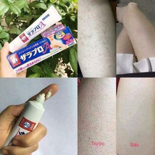 kem trị viêmnang lông