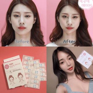 Miếng dán mặt Vline 40 miếng