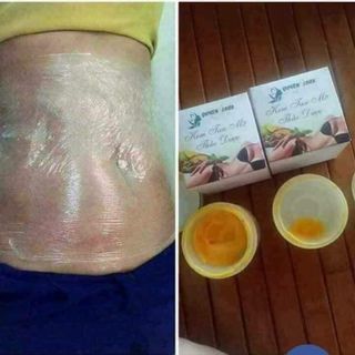 Kem tan mỡ quyên Lara