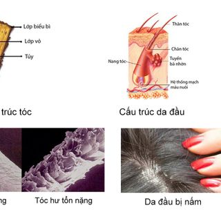 DẦU GỘI AMLA LACO