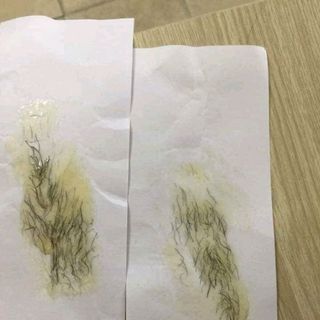 Sáp wax lông
