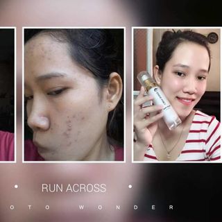 Ủ TRẮNG DA MẶT KÉN TẰM - MASK MILK CREAM HIỆU QUẢ NGAY LẦN ĐẦU THẤY
