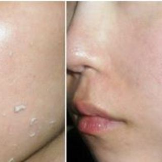 ANSw Lavender Exfoliating Gel Gel Tẩy Tế Bào Chết