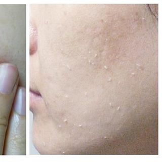 ANSw Lavender Exfoliating Gel Gel Tẩy Tế Bào Chết
