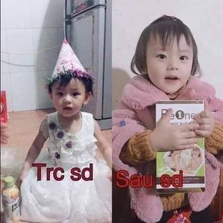NGŨ CỐC TĂNG CÂN LỢI SỮA BEONE