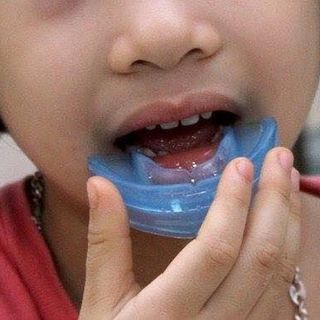 TRAINER T4K FOR KIDS Úc hàm chỉnh nha an toàn cho trẻ em 5-8 tuổi