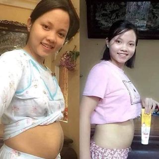 Kem tan mỡ Ngân Bình