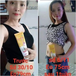 Kem Tan Mỡ Ngân Bình