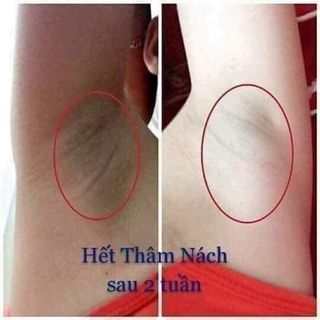 Thảo Mộc Khử mùi hôi nách-chân