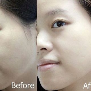 Whitening Face Cream Kem trắng da Oha Beauty