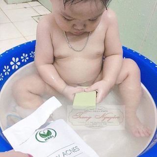 SOAP BODY ACNES trị mụn lưng ngực