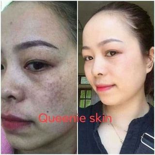 FACE nám QUEENIE SKIN