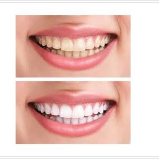 KEM ĐÁNH RĂNG AP24 MỸ -