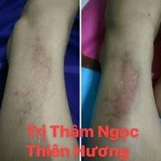 TINH CHẤT TRỊ THÂM NGỌC THIÊN HƯƠNG