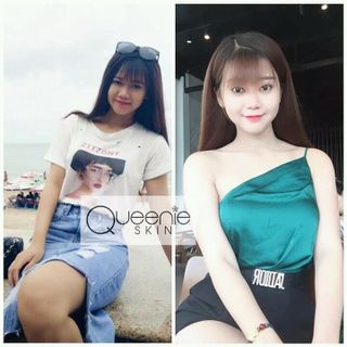 Body cốt lạnh QUEENIE SKIN