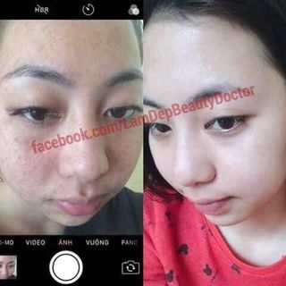 Kem Trắng Da Face Whiterning Day Cream